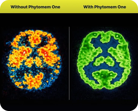 Brain scan illustration comparing brain activity without Phytomem One and with Phytomem One
